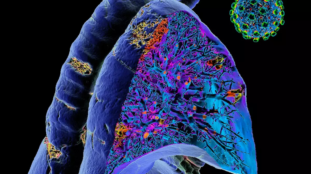 Jak na postcovidový syndrom?